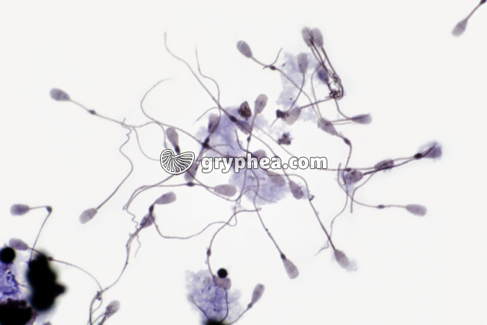 Spermatozoïdes de Taureau x200 - gryphea.com